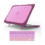 Carcasa Macbook Pro 15 Review y Mejor Oferta
